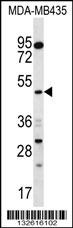 SNX4 Antibody