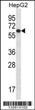 TBC1D22A Antibody