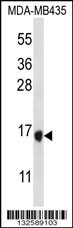 TAC4 Antibody