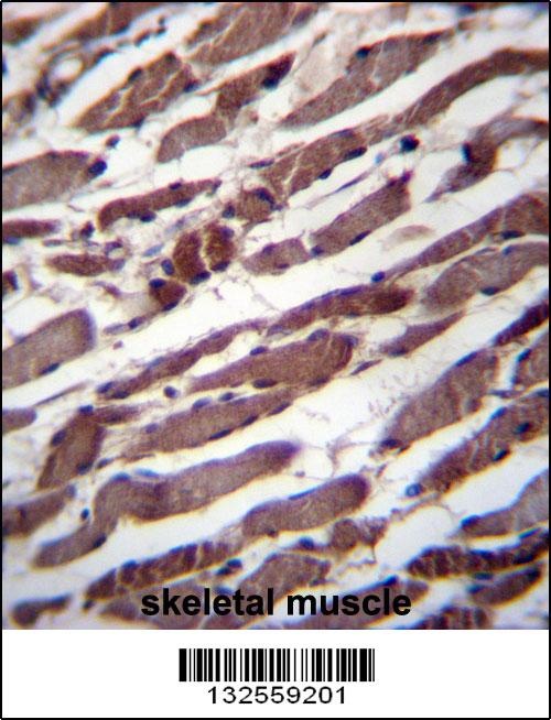 PUS1 Antibody