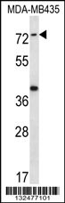 SYTL1 Antibody