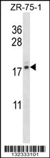 TNP2 Antibody