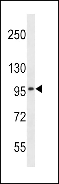SLC8A3 Antibody