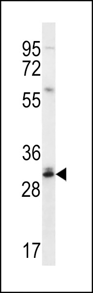 CTDNEP1 Antibody