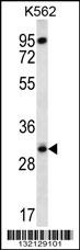 RPS4Y1 Antibody