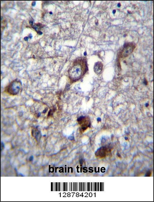 PLEKHH1 Antibody