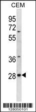 ALKBH4 Antibody