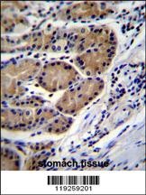 CTSO Antibody
