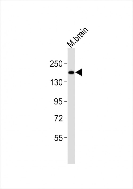 WHSC1L1 Antibody