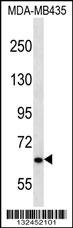 NPHP3 Antibody