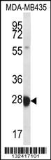 RAB27B Antibody