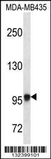 EXTL3 Antibody