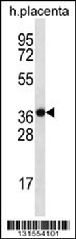 SLC38A8 Antibody
