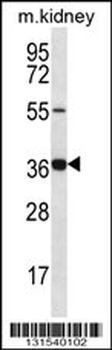 GRXCR1 Antibody