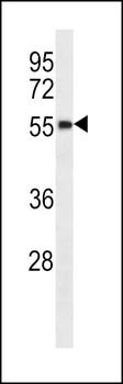 RBM48 Antibody