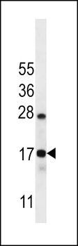 C15orf40 Antibody