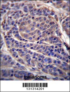 CA6 Antibody