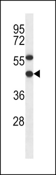 EBNA1BP2 Antibody