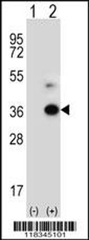 ANGPTL7 Antibody