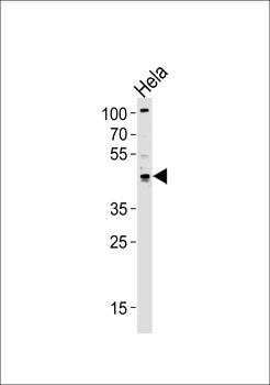 TRIP13 Antibody