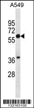 SQLE Antibody