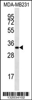 LIX1L Antibody