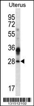 CIB4 Antibody