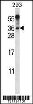 BEND6 Antibody