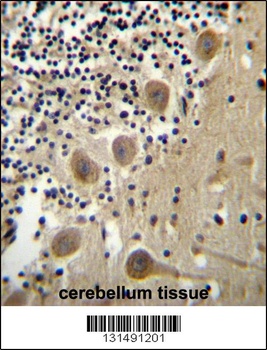 BEND6 Antibody