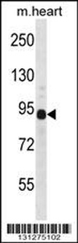 DTNA Antibody