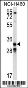 GDF15 Antibody