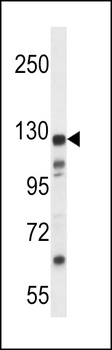 KIAA1324 Antibody