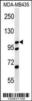 CTNND2 Antibody