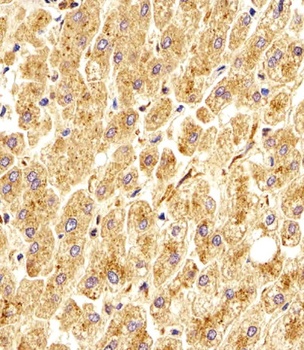 GAA Antibody