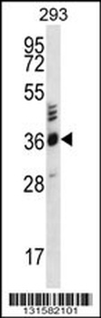 OR2T27 Antibody