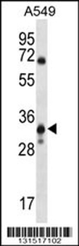 SLC25A53 Antibody