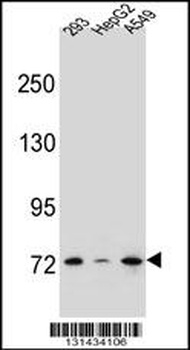 ZNF569 Antibody