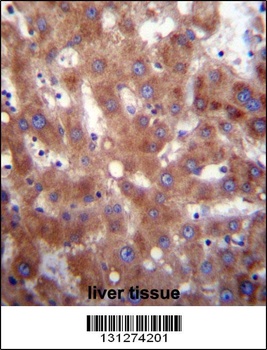 HSD17B4 Antibody