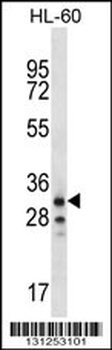 OR6K2 Antibody