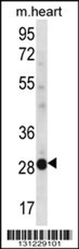 NCCRP1 Antibody
