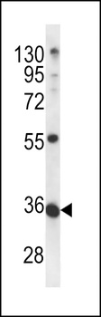 METTL11B Antibody