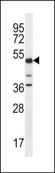 PSTPIP1 Antibody