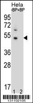 DNAJB6 Antibody