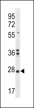 NKAIN1 Antibody