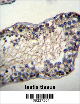 TSSK6 Antibody