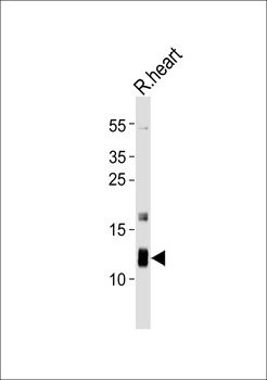 ATP5J Antibody