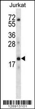 KRTAP13-3 Antibody