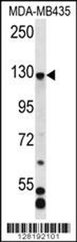 CFAP69 Antibody