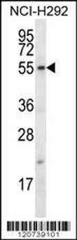 FBXO15 Antibody