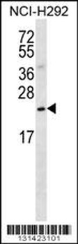SLMO2 Antibody